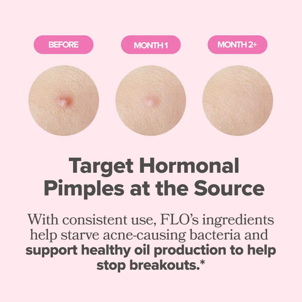 Hormonal Acne Vitamin Capsules